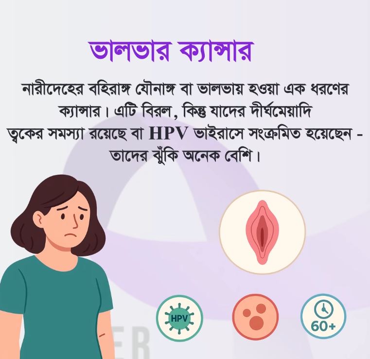 ভালভার ক্যান্সার হল নারীদেহের বহির যৌনাঙ্গ বা ভালভায় হওয়া এক ধরনের ক্যান্সার