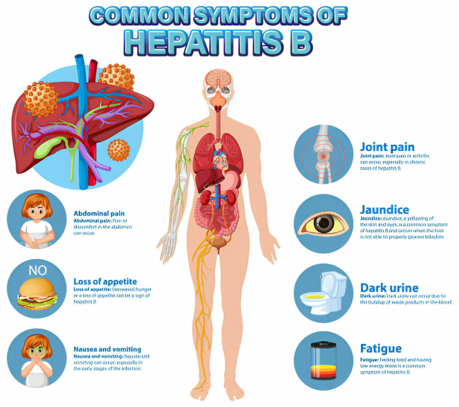 hepatitis b